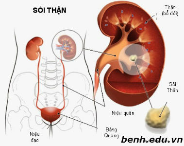 Tim-hieu-benh-soi-than