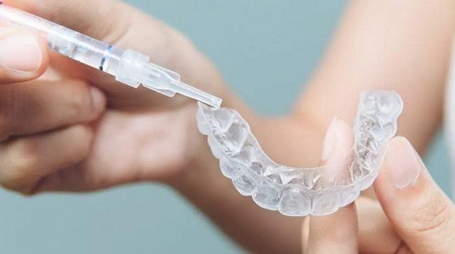 chi phí tẩy trắng răng