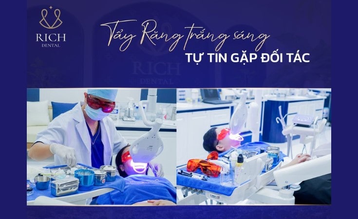 chi phí tẩy trắng răng